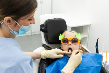 dentist, doctor examines the oral cavity of a little girl, uses a mouth mirror, baby teeth close-up, the concept of pediatric dentistry, dental treatment. - obrazy, fototapety, plakaty