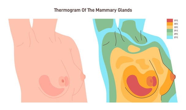 Thermography of female chest. Thermographic image of breast