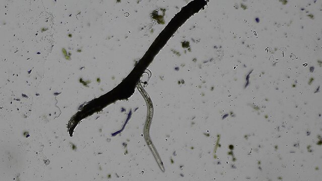 Nematode under the microscope