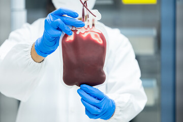 Scientist wear blue gloves hand holding red blood bag from donor at blood bank laboratory.Doctor...