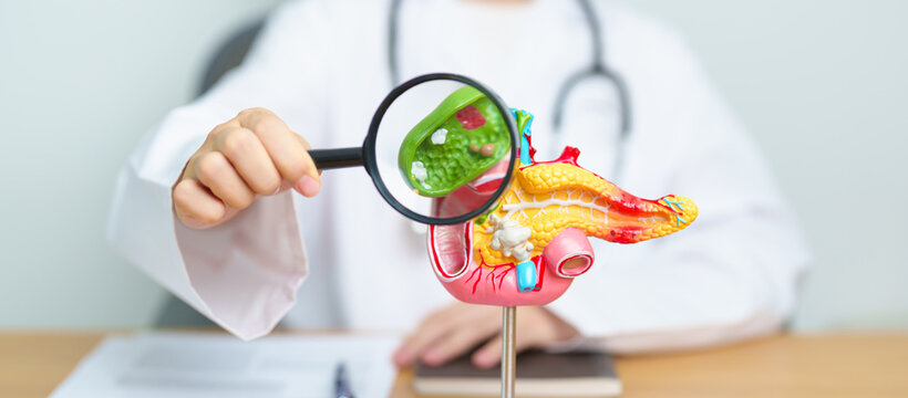 Doctor with human Pancreatitis anatomy model with Pancreas, Gallbladder, Bile Duct, Duodenum, Small intestine and magnifying glass. Pancreatic cancer, acute pancreatitis and Digestive system