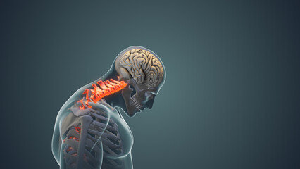 Neck pain or Cervical posture syndrome medical animation