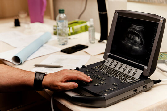 ultrasound equipment. medical equipment for ultrasound. monitor to view information.
