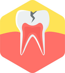 Tooth Cavity