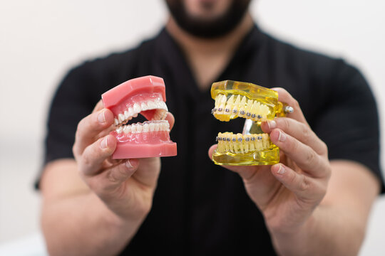 Orthodontist performing metal dental braces and clear aligners on artificial human jaws models dentist demonstrating devices for teeth straightening in hospital closeup