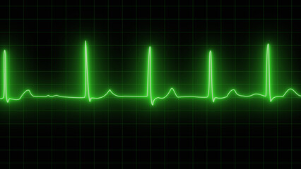 Close up of a medical monitor with green lines of ECG showing atrial fibrillation. neon Close up of electrocardiogram chart background