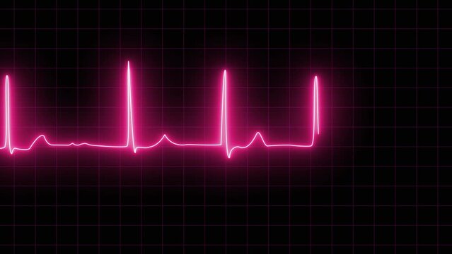 neon Atrial fibrillation ECG loop animation. ECG with supraventricular premature beats and short paroxysms of neon atrial fibrillation animation. Loop EKG Heart Rate In Normal Sinus Rhythm