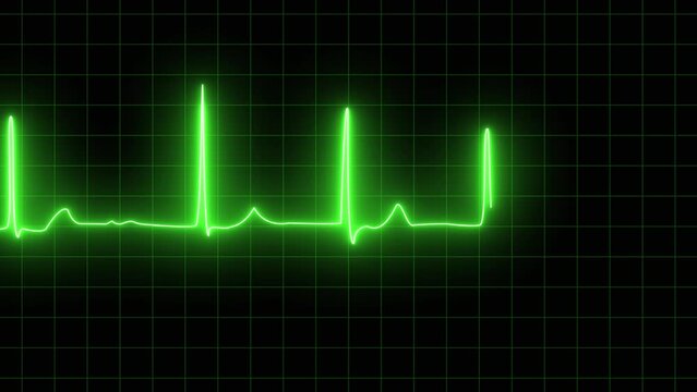 neon Atrial fibrillation ECG loop animation. ECG with supraventricular premature beats and short paroxysms of neon atrial fibrillation animation. Loop EKG Heart Rate In Normal Sinus Rhythm