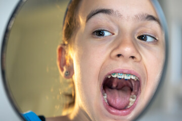 Caucasian preteen girl with braces on her teeth looking at the mirror.