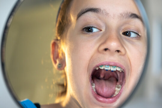 Caucasian preteen girl with braces on her teeth looking at the mirror.
