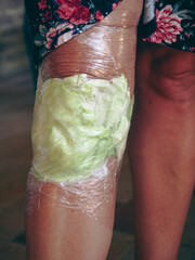 woman knee wrapped with cabbage leaves compress for anti inflammatory pain relief. - obrazy, fototapety, plakaty