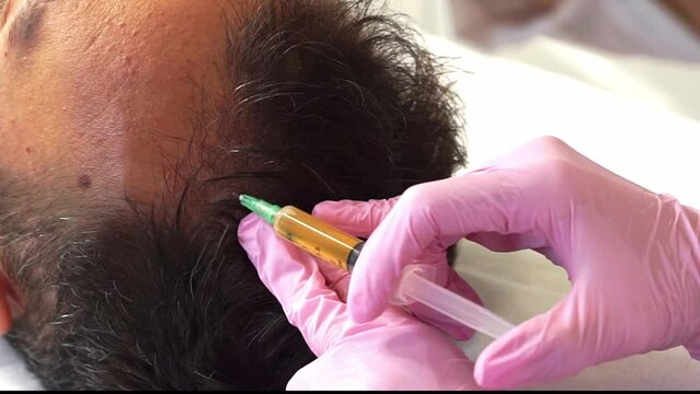 Cosmetologist makes a man prp therapy against hair loss, injections in the scalp in a beauty salon. PRP for hair. The concept of cosmetology.