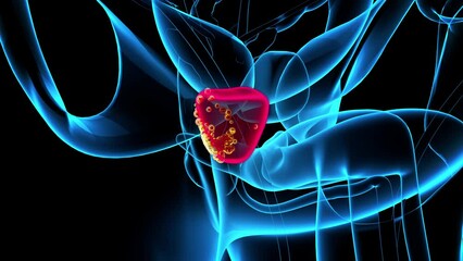 4K abstract 3D animation of the prostate cancer
