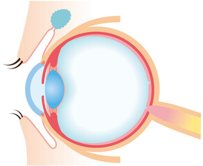 目の構造　断面図　医療