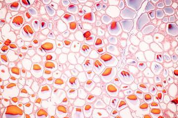 Showing Light micrograph of the Thyroid gland and Thymus gland human Child under the microscope for education in the laboratory.
