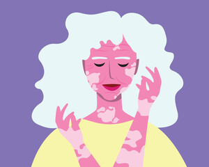 Diverse natural old woman with vitiligo, flat vector stock illustration