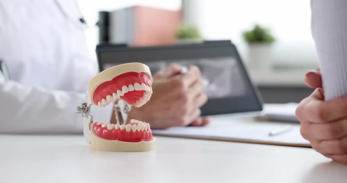 Artificial mock jaw standing on table near dentist doctor and patient 4k movie. Dentistry dental implantation concept