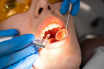 Female dentist removes tartar from her teeth.Visit is carried out in a professional dental clinic....