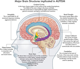 Medical illustration showing major brain structures implicated in autism spectrum disorder, with annotations.
