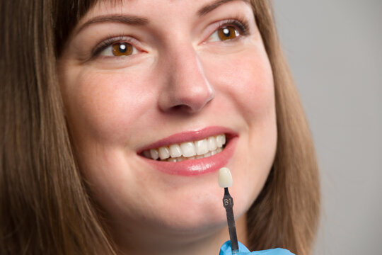 Close-up of dentist's hand using shade guide at woman's mouth to check veneer of teeth for bleaching
