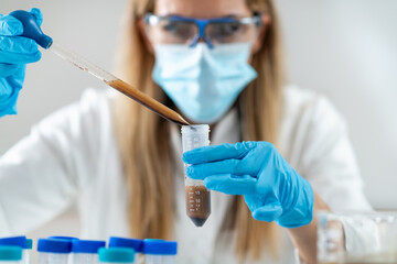 The groundbreaking process of preparing fecal transplant liquid in the lab. This technique holds immense potential for treating various gut-related conditions. - obrazy, fototapety, plakaty