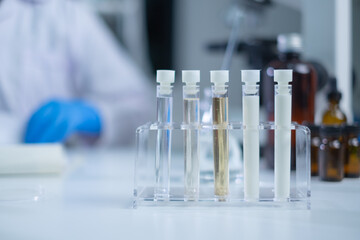 Test tube with a sample of milk. Concept of nutrition, lactose, protein, bacteria, fat and glucose...