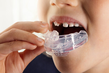 child inserting silicone brace in mouth. poor oral habits correction, jaws aligning and straighten the teeth
