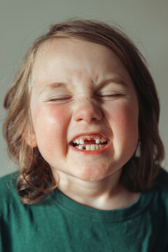 Portrait of a child showing missing teeth