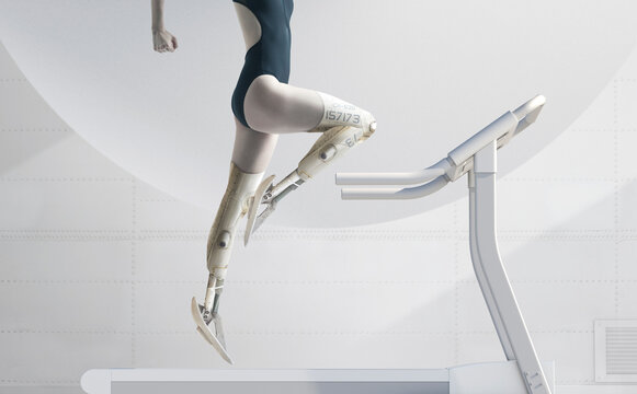 Advance prosthetics