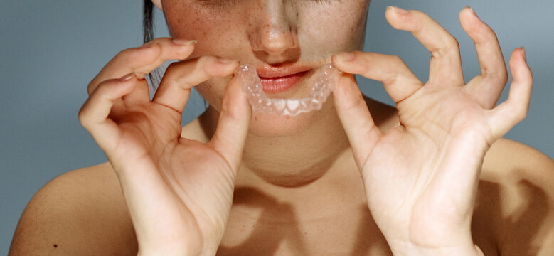 Anonymous woman holding dental retainer
