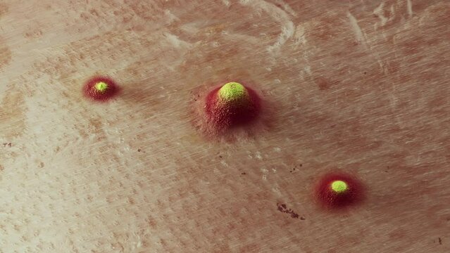 Animation Treatment Acne Repair Skin Scar Removal Pimple Mark Remove. 3D Render