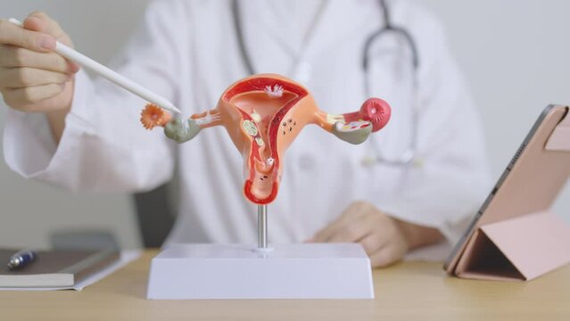 Doctor with Uterus and Ovaries anatomy model and tablet. Ovarian and Cervical cancer, Cervix disorder, Endometriosis, Hysterectomy, Uterine fibroids, Reproductive system, Pregnancy