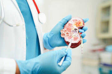 Chronic kidney disease, doctor holding model for treatment urinary system, urology, Estimated...