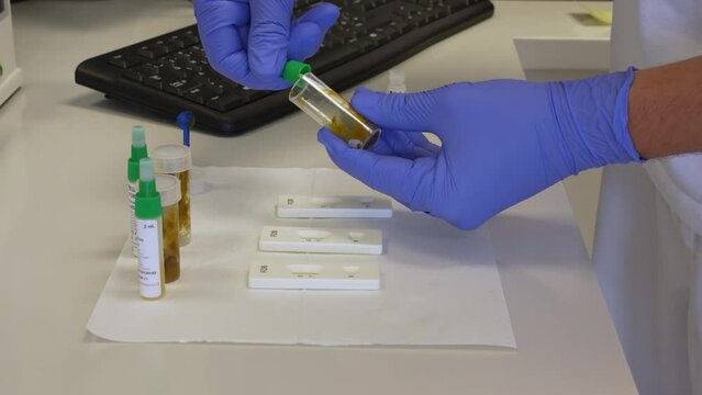 Laboratory assistant swapping human stool samples with a small rod and mixing the feces to prepare samples for testing on blood with rapid test cassette in small laboratory in clinic