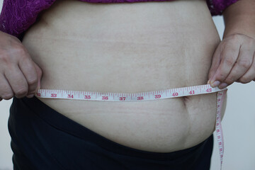 Closeup woman hands measure her big belly, fat with cellulite abdomen by using measuring tape. Concept, obesity. Overweight. Body shape problem for woman after pregnancy or getting older.    - obrazy, fototapety, plakaty
