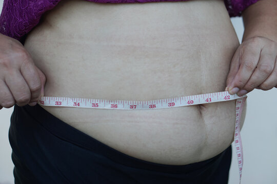 Closeup woman hands measure her big belly, fat with cellulite abdomen by using measuring tape. Concept, obesity. Overweight. Body shape problem for woman after pregnancy or getting older.   