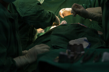 Medical team of surgeon in hospital working surgical intervention in operating room with...