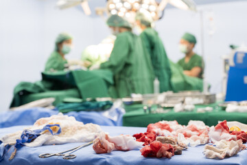 White gauzes for blood lining and blurry doctor operating team background.Messy bloody gauze bandages on the table in the operation room.