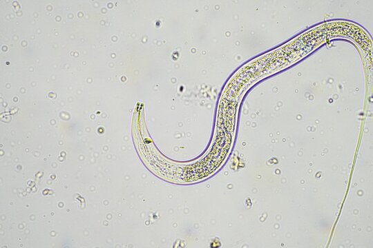 soil switcher nematode, microorganism and soil biology, with nematodes and fungi under the microscope. in a soil and compost sample