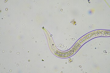 soil switcher nematode, microorganism and soil biology, with nematodes and fungi under the...