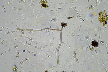 fungi hyphae growing in a healthy soil on a farm