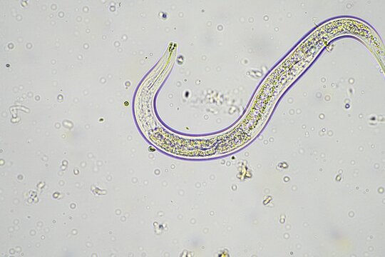 soil switcher nematode, microorganism and soil biology, with nematodes and fungi under the microscope. in a soil and compost sample