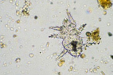 micro arthropods,soil microbes organisms in a soil and compost sample, fungus and fungi and under...