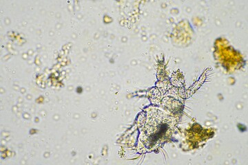 micro arthropods,soil microbes organisms in a soil and compost sample, fungus and fungi and under...