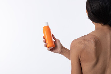 Back of woman with sunburn holding sunscreen bottle. Isolated on white background with copy space.