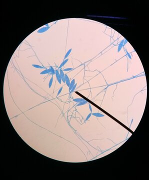 Microscopy of Microsporum gypseum, Microsporum gypseum microconidia