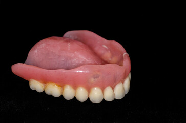 Close-up human denture of the upper jaw on a black background © adel