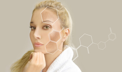 Dark spots, freckles,hyperpigmentation(melasma or chloasma),concept - skin lightening, skin whitening, fruit acids,AHA, Skin Brightening