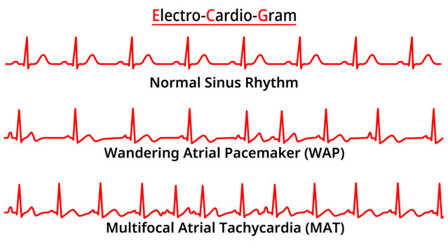 Wap Bilder Durchsuchen 4,502 Archivfotos, und Videos