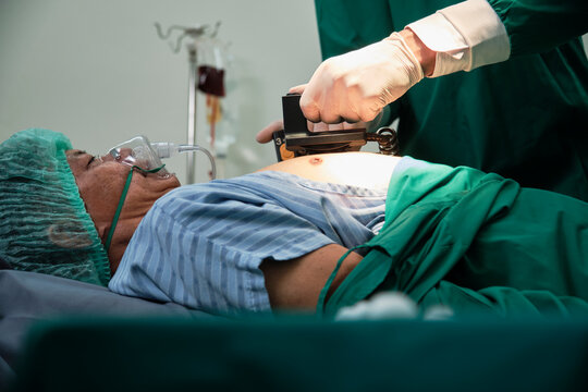 Professional ICU doctor CPR helps to defibrillate for life safety, critically and coma-ill patients surgery in hospital emergency room, and intensive shock rescue operations.